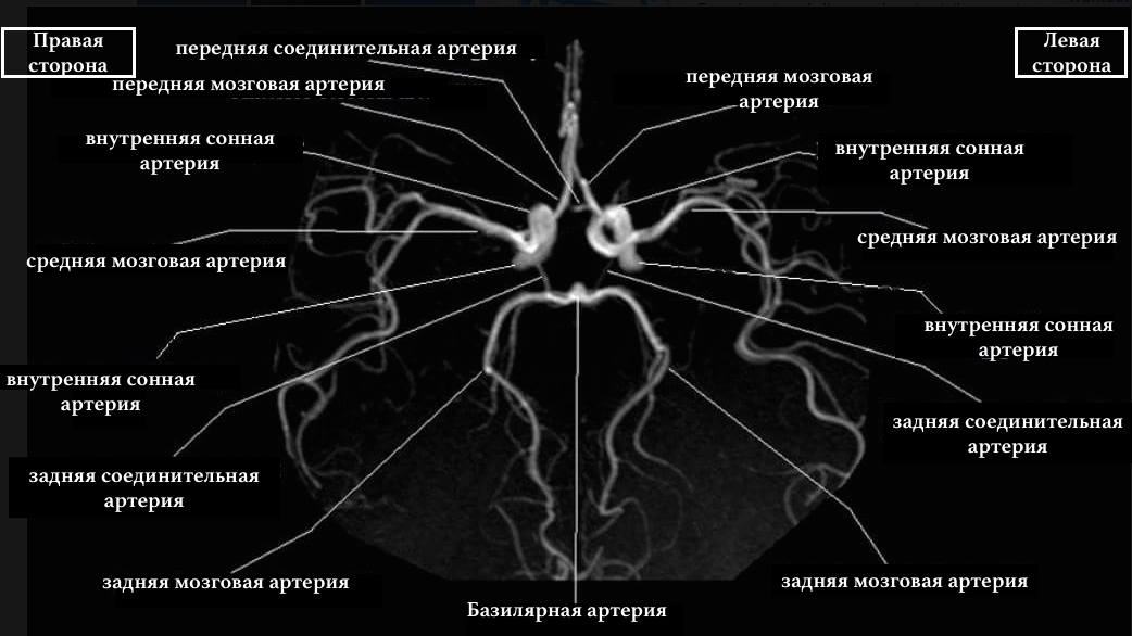 сосуды головного мозга