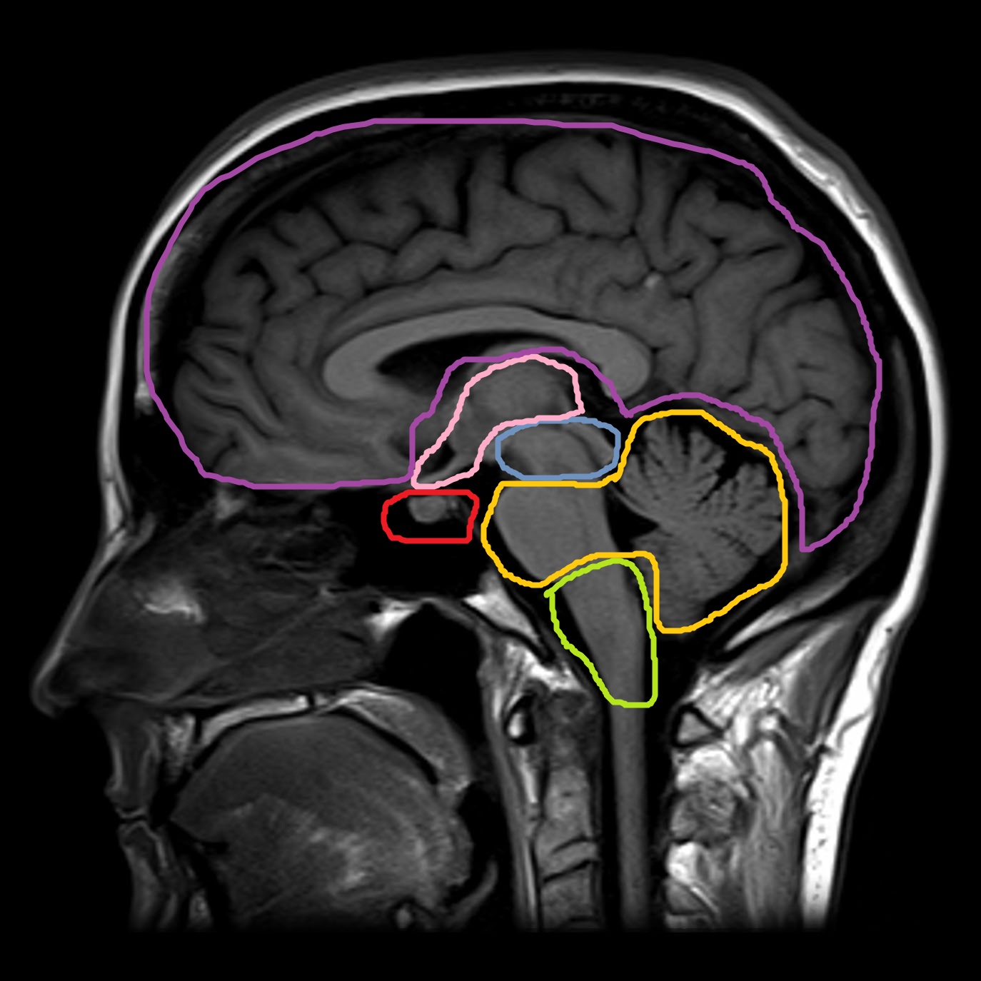 МР-анатомия головного мозга — 24Radiology.ru